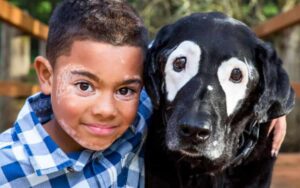 Un bambino ritrova il sorriso quando incontra un cane con la stessa problematica