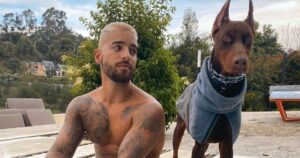 Maluma viene attaccato dal suo cane Doberman e mostra la ferita che gli ha lasciato sul viso